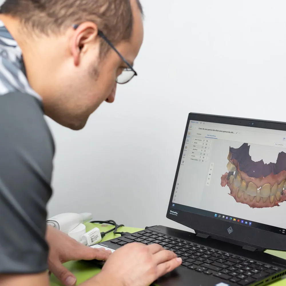 Contamos con escáner intraoral 3D
