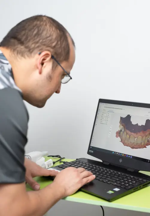Implantes dentales